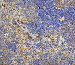 Invitrogen IL-31 Polyclonal Antibody 100 μg; Unconjugated:Antibodies,