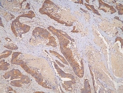 Invitrogen IL-31 Polyclonal Antibody 100 μg; Unconjugated:Antibodies,