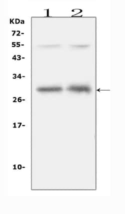 Invitrogen IL-31 Polyclonal Antibody 100 μg; Unconjugated:Antibodies,