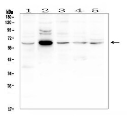 Invitrogen EGFL6 Polyclonal Antibody 100 &mu;g; Unconjugated:Antibodies,