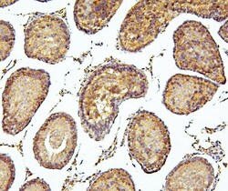 Invitrogen PEF1 Polyclonal Antibody 100 &mu;g | Buy Online | Invitrogen&trade; | Fisher Scientific