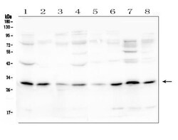 Invitrogen PEF1 Polyclonal Antibody 100 &mu;g | Buy Online | Invitrogen&trade; | Fisher Scientific