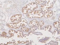 Invitrogen ATP5G1/2/3 Polyclonal Antibody 100 &mu;g; Unconjugated:Antibodies,