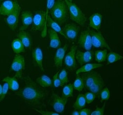 Invitrogen ATP5G1/2/3 Polyclonal Antibody 100 &mu;g; Unconjugated:Antibodies,