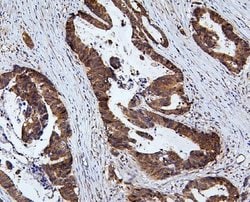Invitrogen RNF169 Polyclonal Antibody 100 &mu;g; Unconjugated:Antibodies,
