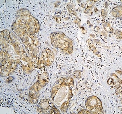 Invitrogen CPAMD8 Polyclonal Antibody 100 &mu;g; Unconjugated:Antibodies,