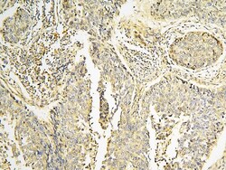 Invitrogen CPAMD8 Polyclonal Antibody 100 &mu;g; Unconjugated:Antibodies,
