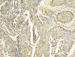 CPAMD8 Polyclonal Antibody, Invitrogen&trade; 100 &mu;g; Unconjugated 