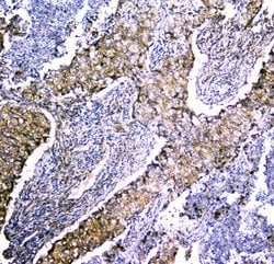 Invitrogen LRTOMT Polyclonal Antibody 100 &mu;g; Unconjugated:Antibodies,