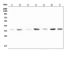 Invitrogen C22orf29 Polyclonal Antibody 100 &mu;g; Unconjugated:Antibodies,