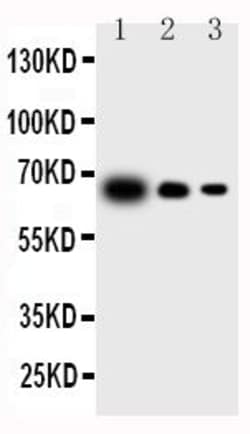 Invitrogen IL-23 p19 Polyclonal Antibody 100 &mu;g; Unconjugated:Antibodies,