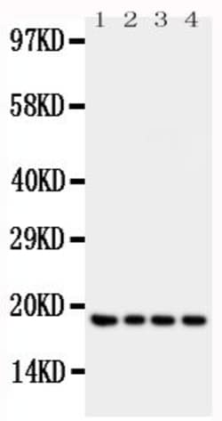 Invitrogen IFNG Polyclonal Antibody 100 &mu;g; Unconjugated:Antibodies,