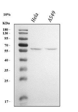 Invitrogen KLF5 Polyclonal Antibody 100 &mu;g; Unconjugated:Antibodies,
