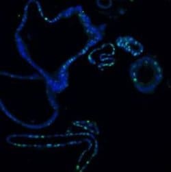 Invitrogen Ki67 Polyclonal Antibody 100 &mu;g; Unconjugated:Antibodies,