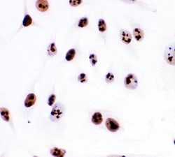 Invitrogen Ki67 Polyclonal Antibody 100 &mu;g; Unconjugated:Antibodies,