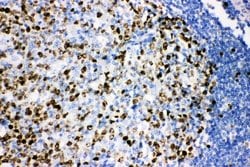 Invitrogen Ki67 Polyclonal Antibody 100 &mu;g; Unconjugated:Antibodies,