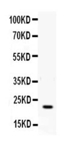 Invitrogen IFN gamma Polyclonal Antibody 100 &mu;g | Buy Online | Invitrogen&trade; | Fisher Scientific
