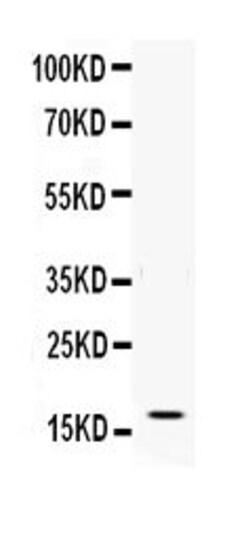 Invitrogen IFN gamma Polyclonal Antibody 100 &mu;g; Unconjugated:Antibodies,