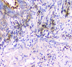Invitrogen IFN gamma Polyclonal Antibody 100 &mu;g; Unconjugated:Antibodies,