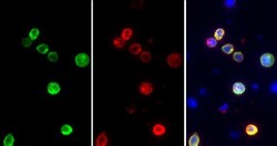 Invitrogen SARS-CoV-2 Spike Protein S1 Polyclonal Antibody 100 &mu;L | Buy Online | Invitrogen&trade; | Fisher Scientific