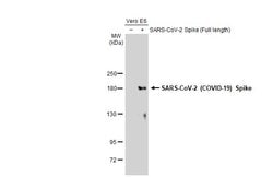 Invitrogen SARS-CoV-2 Spike Protein S1 Polyclonal Antibody 100 &mu;L | Buy Online | Invitrogen&trade; | Fisher Scientific