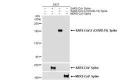 Invitrogen SARS-CoV-2 Spike Protein S1 Polyclonal Antibody 100 &mu;L | Buy Online | Invitrogen&trade; | Fisher Scientific