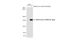 Invitrogen SARS-CoV-2 Spike Protein S1 Polyclonal Antibody 100 &mu;L | Buy Online | Invitrogen&trade; | Fisher Scientific