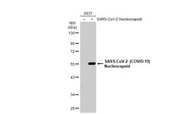 SARS-CoV-2 Nucleocapsid Polyclonal Antibody, Invitrogen 100 &mu;L; Unconjugated:Antibodies,