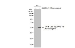 SARS-CoV-2 Nucleocapsid Polyclonal Antibody, Invitrogen 100 &mu;L; Unconjugated:Antibodies,
