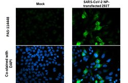 SARS-CoV-2 Nucleocapsid Polyclonal Antibody, Invitrogen 100 &mu;L; Unconjugated:Antibodies,