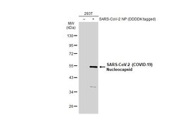 SARS-CoV-2 Nucleocapsid Polyclonal Antibody, Invitrogen 100 &mu;L; Unconjugated:Antibodies,