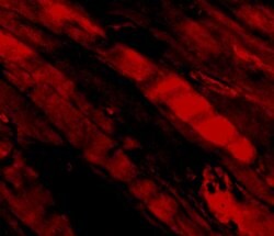 Invitrogen Emerin Polyclonal Antibody 100 &mu;g; Unconjugated:Antibodies,