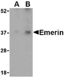 Invitrogen Emerin Polyclonal Antibody 100 &mu;g; Unconjugated:Antibodies,