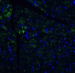 Invitrogen IL-17A Polyclonal Antibody 100 &mu;g | Buy Online | Invitrogen&trade; | Fisher Scientific