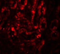 Invitrogen IL-17A Polyclonal Antibody 100 &mu;g | Buy Online | Invitrogen&trade; | Fisher Scientific