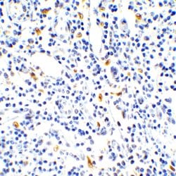 Invitrogen IL-17A Polyclonal Antibody 100 &mu;g | Buy Online | Invitrogen&trade; | Fisher Scientific