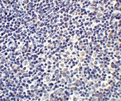 Invitrogen IL-17A Polyclonal Antibody 100 &mu;g | Buy Online | Invitrogen&trade; | Fisher Scientific