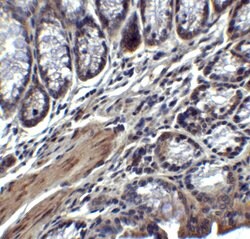 Invitrogen IL-17A Polyclonal Antibody 100 &mu;g | Buy Online | Invitrogen&trade; | Fisher Scientific