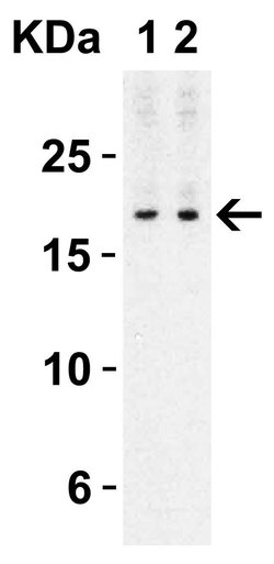 Invitrogen IL-17A Polyclonal Antibody 100 &mu;g | Buy Online | Invitrogen&trade; | Fisher Scientific