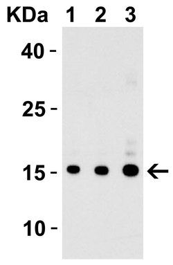 Invitrogen IL-17A Polyclonal Antibody 100 &mu;g | Buy Online | Invitrogen&trade; | Fisher Scientific