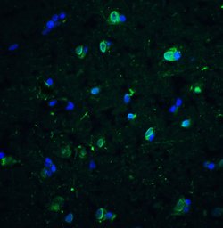 Invitrogen CD81 Polyclonal Antibody 100 &mu;g; Unconjugated:Antibodies,