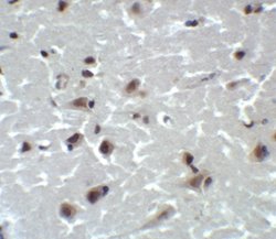 Invitrogen CD81 Polyclonal Antibody 100 &mu;g; Unconjugated:Antibodies,