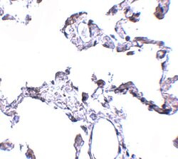 Invitrogen CD81 Polyclonal Antibody 100 &mu;g; Unconjugated:Antibodies,