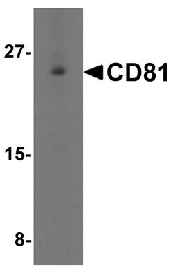 Invitrogen CD81 Polyclonal Antibody 100 &mu;g; Unconjugated:Antibodies,