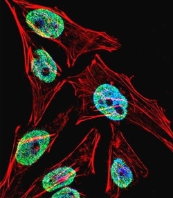 Invitrogen&trade;&nbsp;TERT Polyclonal Antibody