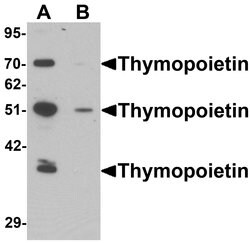 Invitrogen LAP2 Polyclonal Antibody 100 &mu;g; Unconjugated:Antibodies,