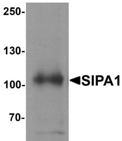 Invitrogen SIPA1 Polyclonal Antibody 100 &mu;g; Unconjugated:Antibodies,