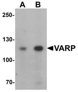 Invitrogen ANKRD27 Polyclonal Antibody 100 &mu;g; Unconjugated:Antibodies,