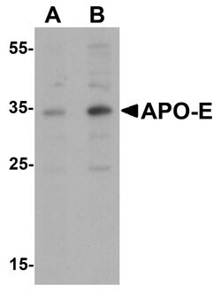 Invitrogen APOE Polyclonal Antibody 100 &mu;g; Unconjugated:Antibodies,