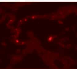 Invitrogen MMP9 Polyclonal Antibody 100 &mu;g; Unconjugated:Antibodies,